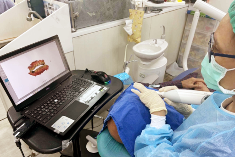 牙科數位客製下顎前突裝置　新竹臺大改善睡眠呼吸中止症新解方